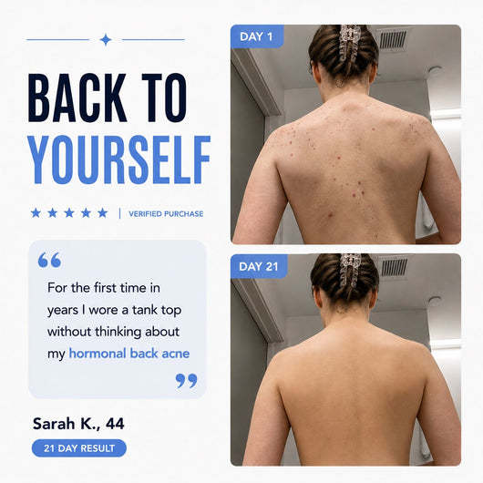 Clyrr Back Acne Bar™