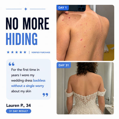 Clyrr Back Acne Bar™
