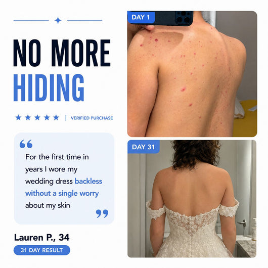 Clyrr Back Acne Bar™