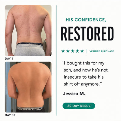 Clyrr Back Acne Body Wash