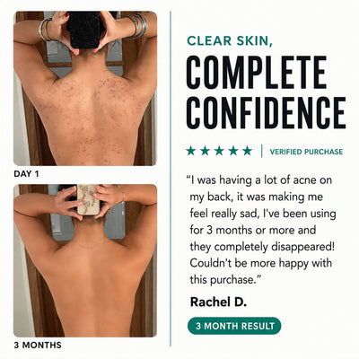 Clyrr Back Acne Body Wash