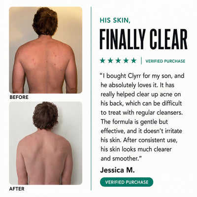 Clyrr Back Acne Body Wash